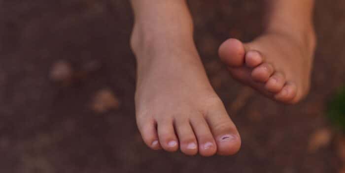 agressions-exterieures-pieds